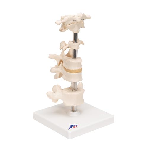 6 분리 척추 모형 Model of 6 Human Vertebrae, Mounted on Stand (atlas, axis, cervical, 2x thoracic, lumbar), 1000147 [A75], 척추뼈 모형