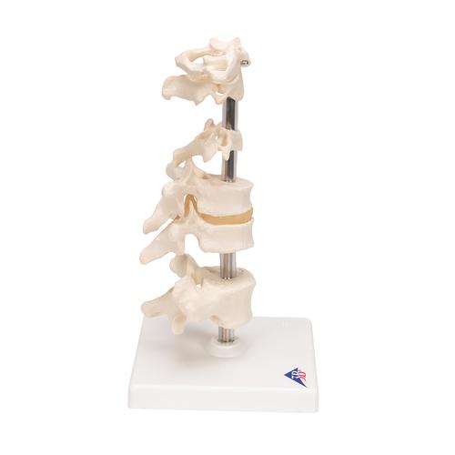 Model of 6 Human Vertebrae, Mounted on Stand (atlas, axis, cervical, 2x thoracic, lumbar), 1000147 [A75], Vertebra Models