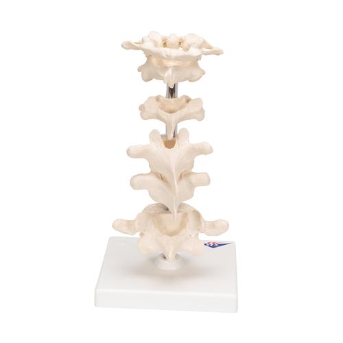 6 분리 척추 모형 Model of 6 Human Vertebrae, Mounted on Stand (atlas, axis, cervical, 2x thoracic, lumbar), 1000147 [A75], 척추뼈 모형