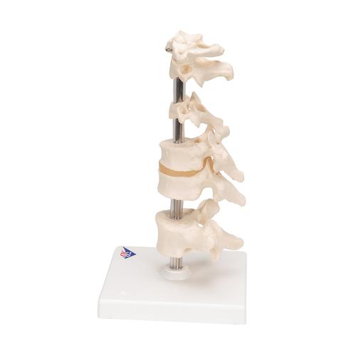 Model of 6 Human Vertebrae, Mounted on Stand (atlas, axis, cervical, 2x thoracic, lumbar), 1000147 [A75], Vertebra Models