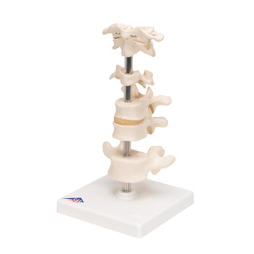 6 분리 척추 모형 Model of 6 Human Vertebrae, Mounted on Stand (atlas, axis, cervical, 2x thoracic, lumbar), 1000147 [A75], 척추뼈 모형