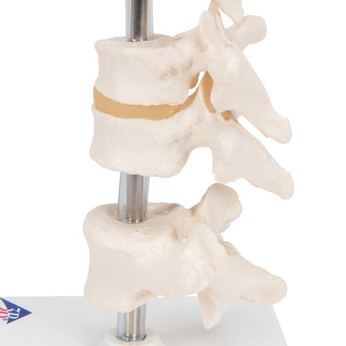 6 분리 척추 모형 Model of 6 Human Vertebrae, Mounted on Stand (atlas, axis, cervical, 2x thoracic, lumbar), 1000147 [A75], 척추뼈 모형