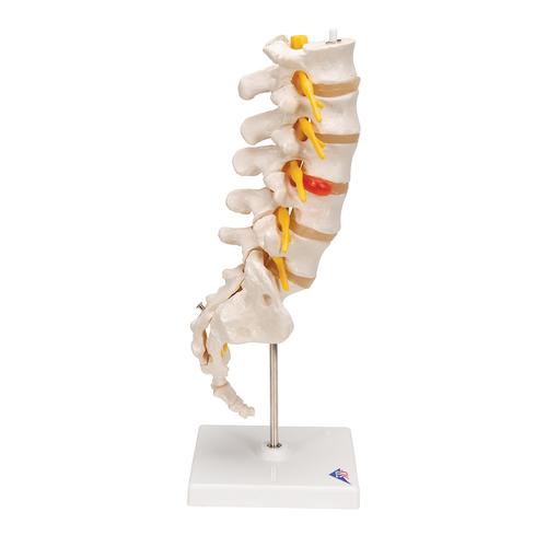 Columnavertebral lumbar con hernia discal dorsolateral, 1000150 [A76/5], Modelos de vértebras