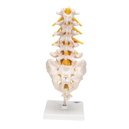 Human Lumbar Spinal Column Model with Dorso-Lateral Prolapsed Intervertebral Disc, 1000150 [A76/5], Vertebra Models