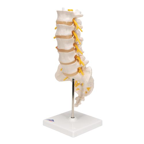 Human Lumbar Spinal Column Model with Dorso-Lateral Prolapsed Intervertebral Disc, 1000150 [A76/5], Vertebra Models