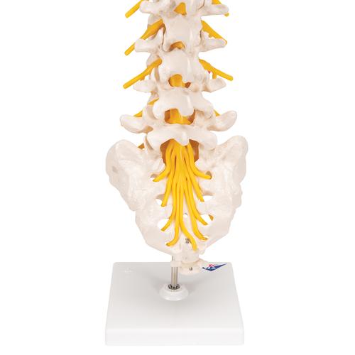 Colonna vertebrale lombare con ernia del disco dorsolaterale, 1000150 [A76/5], Modelli di vertebre