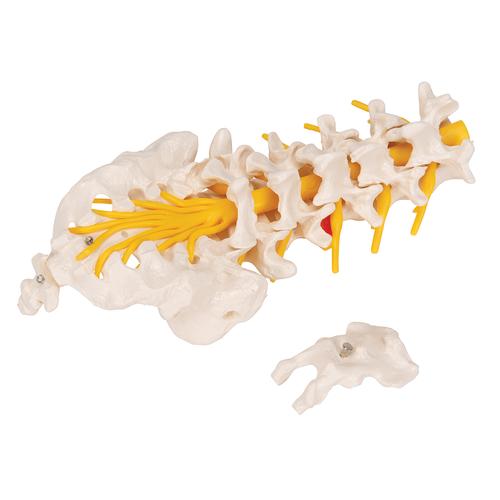 Columnavertebral lumbar con hernia discal dorsolateral, 1000150 [A76/5], Modelos de vértebras