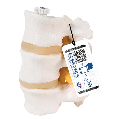 3 Human Lumbar Vertebrae, Flexibly Mounted, 1000151 [A76/8], Vertebra Models