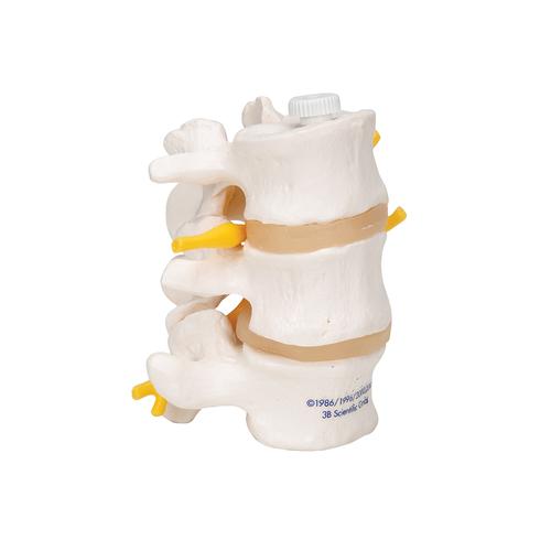 3 Human Lumbar Vertebrae, Flexibly Mounted, 1000151 [A76/8], Vertebra Models