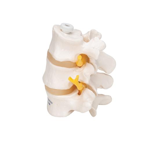 3 Human Lumbar Vertebrae, Flexibly Mounted, 1000151 [A76/8], Vertebra Models