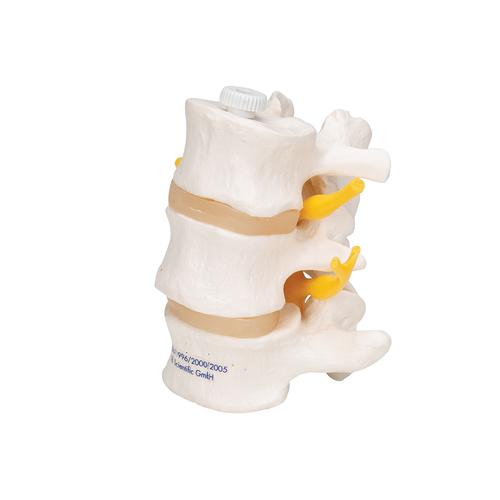 3 Human Lumbar Vertebrae, Flexibly Mounted, 1000151 [A76/8], Vertebra Models