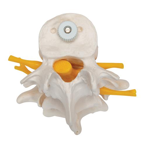 3 Human Lumbar Vertebrae, Flexibly Mounted, 1000151 [A76/8], Vertebra Models