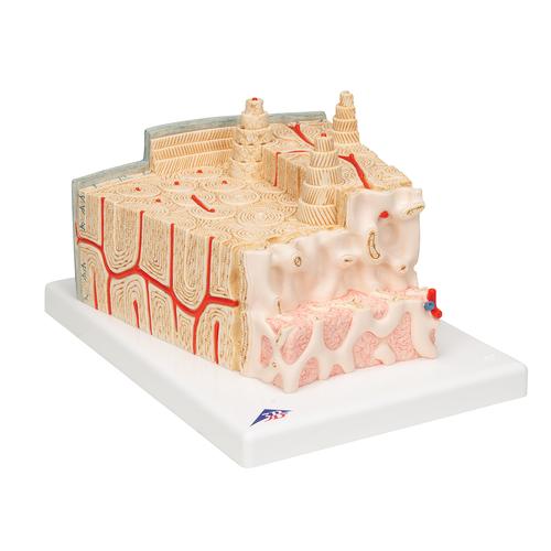 3B MICROanatomy Estructura de los huesos - aumentado 80 veces, 1000154 [A79], 3B MICROanatomy™