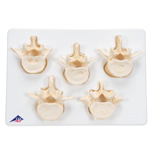 Set of 5 BONElike Lumbar Vertebrae, 1000155 [A792], Vertebra Models