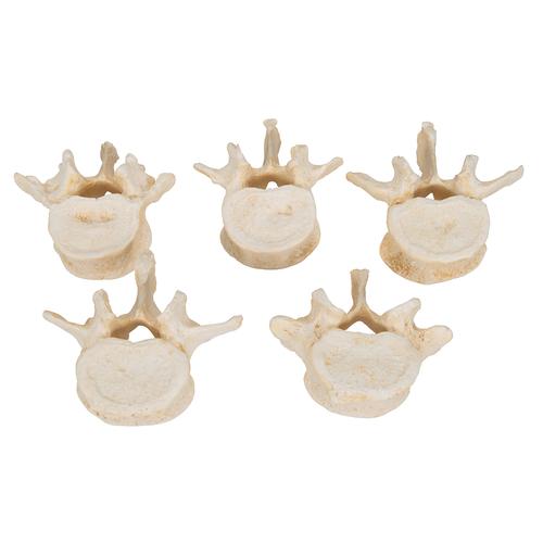 Set of 5 BONElike Lumbar Vertebrae, 1000155 [A792], Vertebra Models