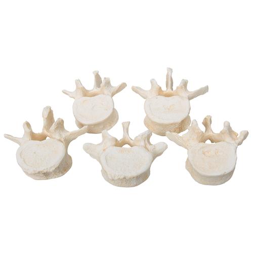 Set of 5 BONElike Lumbar Vertebrae, 1000155 [A792], Vertebra Models