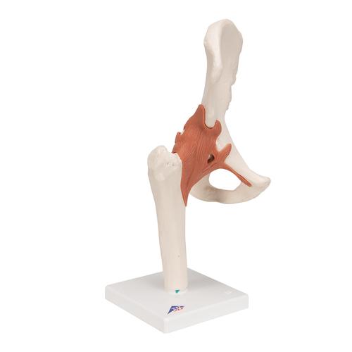 엉덩이 관절(고관절) 모형 Functional Hip Joint, 1000161 [A81], 관절 모형