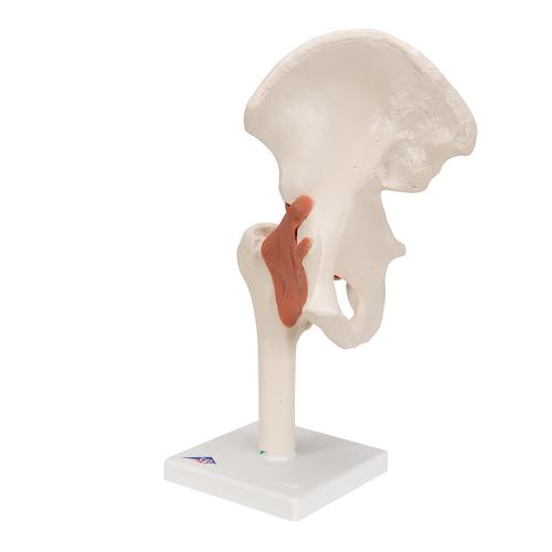 엉덩이 관절(고관절) 모형 Functional Hip Joint, 1000161 [A81], 관절 모형