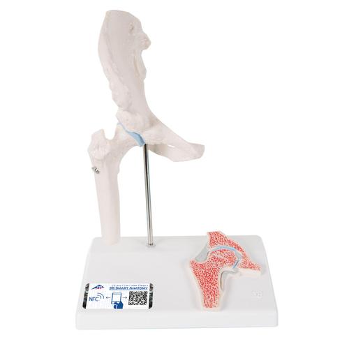 관절 단면이 포함된 소형(미니) 엉덩이 관절(고관절) 모형 Mini Hip Joint with cross-section, 1000168 [A84/1], 관절 모형