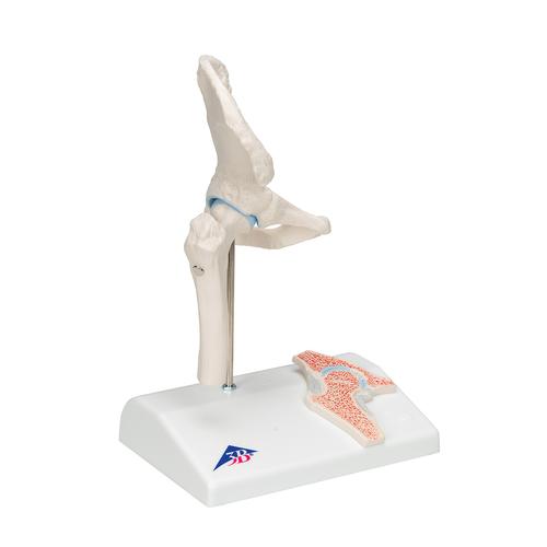 관절 단면이 포함된 소형(미니) 엉덩이 관절(고관절) 모형 Mini Hip Joint with cross-section, 1000168 [A84/1], 관절 모형