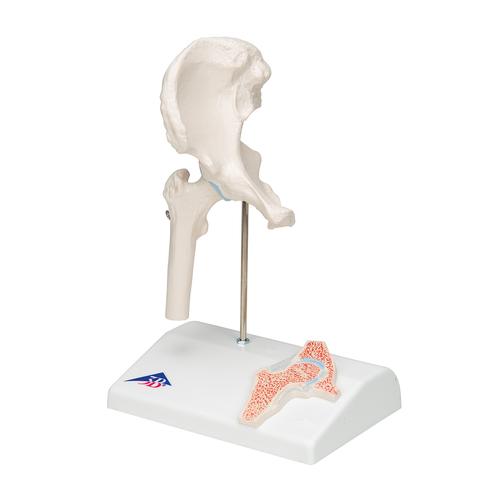 Mini Anatomie Modell Hüftgelenk, mit Querschnitt, 1000168 [A84/1], Gelenkmodelle