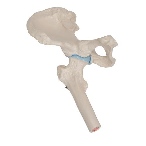 관절 단면이 포함된 소형(미니) 엉덩이 관절(고관절) 모형 Mini Hip Joint with cross-section, 1000168 [A84/1], 관절 모형