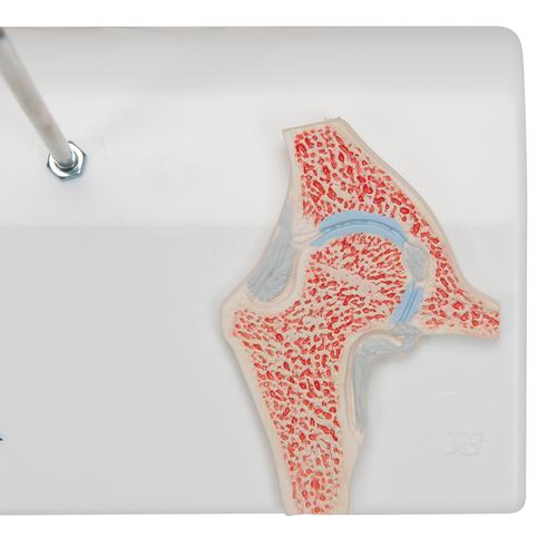 Mini Human Hip Joint Model with Cross Section, 1000168 [A84/1], Joint Models