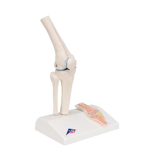 관절 단면이 포함된 소형(미니) 무릎 관절(슬관절) 모형 Mini Human Knee Joint Model with Cross Section, 1000170 [A85/1], 관절 모형