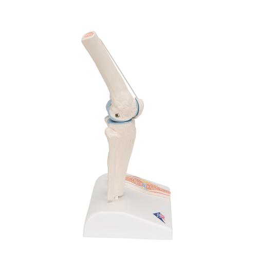 관절 단면이 포함된 소형(미니) 무릎 관절(슬관절) 모형 Mini Human Knee Joint Model with Cross Section, 1000170 [A85/1], 관절 모형