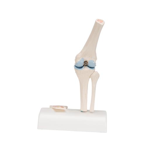 관절 단면이 포함된 소형(미니) 무릎 관절(슬관절) 모형 Mini Human Knee Joint Model with Cross Section, 1000170 [A85/1], 관절 모형