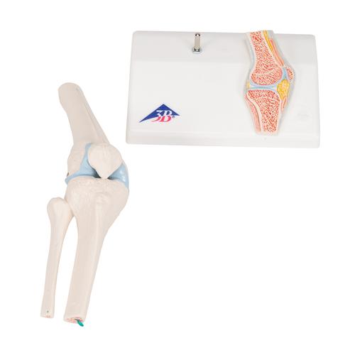 관절 단면이 포함된 소형(미니) 무릎 관절(슬관절) 모형 Mini Human Knee Joint Model with Cross Section, 1000170 [A85/1], 관절 모형