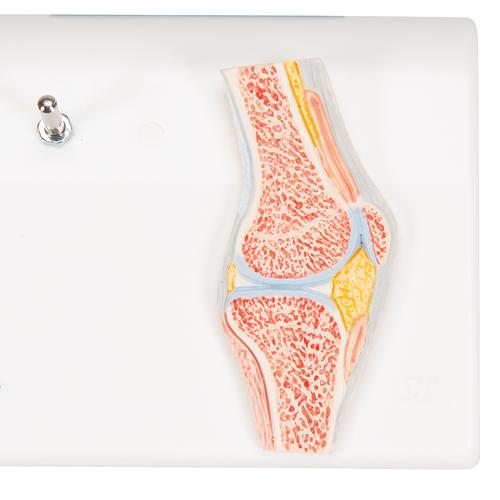 관절 단면이 포함된 소형(미니) 무릎 관절(슬관절) 모형 Mini Human Knee Joint Model with Cross Section, 1000170 [A85/1], 관절 모형