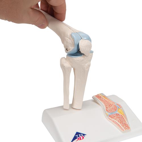 관절 단면이 포함된 소형(미니) 무릎 관절(슬관절) 모형 Mini Human Knee Joint Model with Cross Section, 1000170 [A85/1], 관절 모형