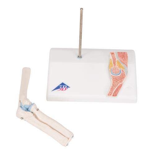 관절 단면이 포함된 소형(미니) 팔꿈치 관절(주관절) 모형 Mini Human Elbow Joint Model with Cross Section, 1000174 [A87/1], 관절 모형