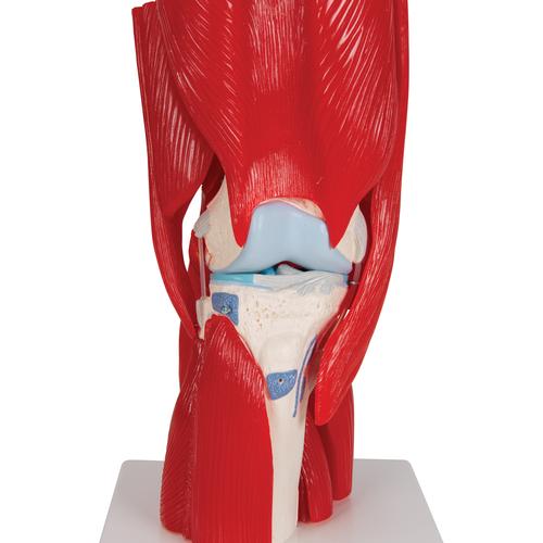 무릎관절(슬관절) 근육 모형 12파트 Knee Joint with Removable Muscles, 12 part, 1000178 [A882], 관절 모형