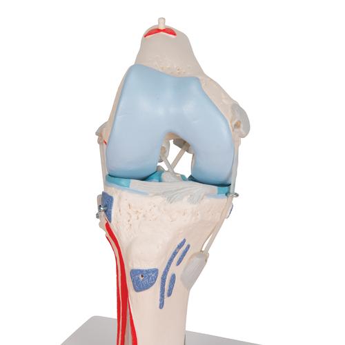 무릎관절(슬관절) 근육 모형 12파트 Knee Joint with Removable Muscles, 12 part, 1000178 [A882], 관절 모형