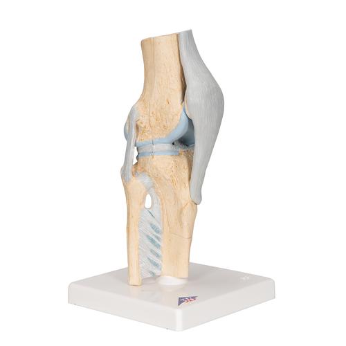 Sectional Human Knee Joint Model, 3 part, 1000180 [A89], Joint Models