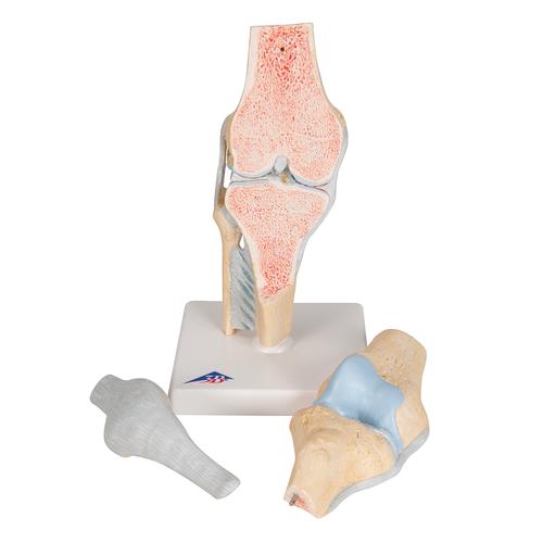 무릎관절 단면모형 3 파트 분리 Sectional Knee Joint Model, 3 part, 1000180 [A89], 관절 모형