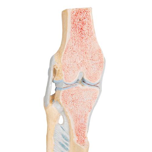 Sectional Human Knee Joint Model, 3 part, 1000180 [A89], Joint Models