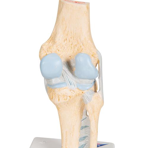 Sectional Human Knee Joint Model, 3 part, 1000180 [A89], Joint Models