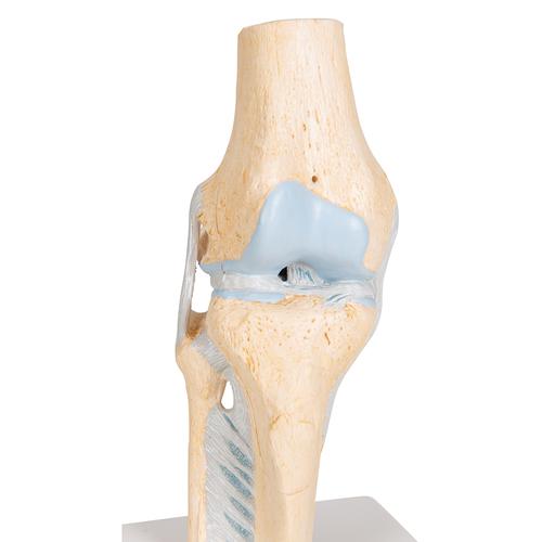 Sectional Human Knee Joint Model, 3 part, 1000180 [A89], Joint Models