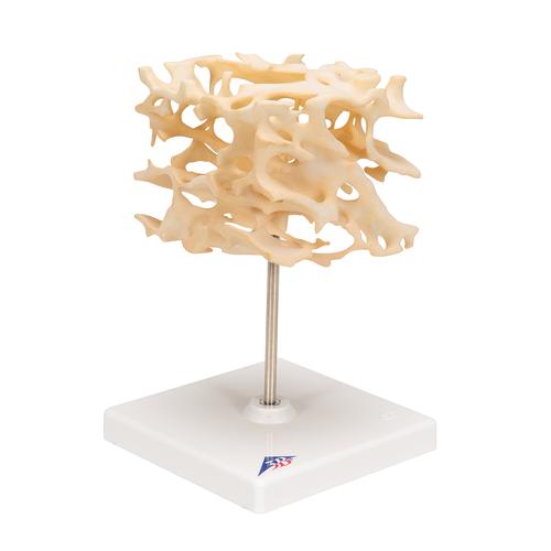 Human Cancellous Bone Model, Enlarged 100 times, 1009698 [A99], Microanatomy Models 