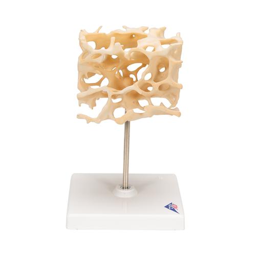 Human Cancellous Bone Model, Enlarged 100 times, 1009698 [A99], Microanatomy Models 