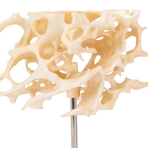 Human Cancellous Bone Model, Enlarged 100 times, 1009698 [A99], Individual Bone Models