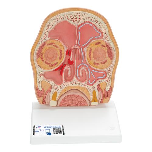 Kopfmodell frontal geschnitten in anatomischer Höhe der Nasennebenhöhlen (mit Sinusitis), 1012789 [C13/1], Kopfmodelle