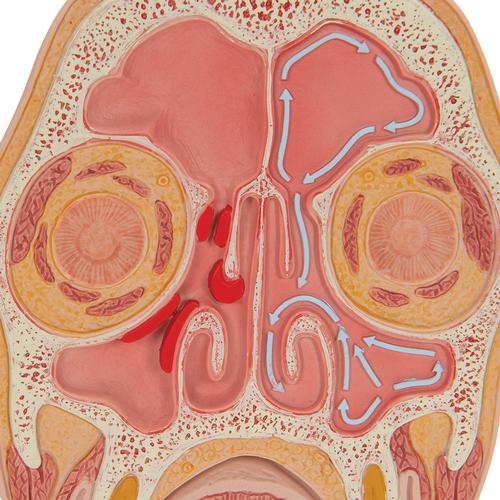 Kopfmodell frontal geschnitten in anatomischer Höhe der Nasennebenhöhlen (mit Sinusitis), 1012789 [C13/1], Kopfmodelle