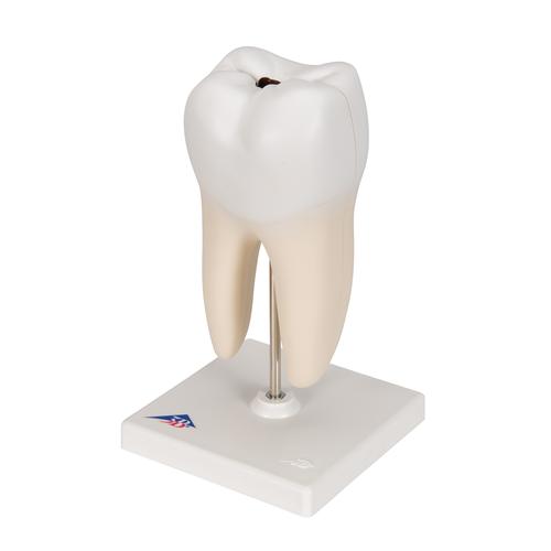 Lower Twin-Root Molar with Cavities Human Tooth Model, 2 part, 1000243 [D10/4], Dental Models