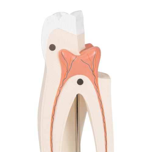 Dente molare superiore a tre radici, in 3 parti, 1017580 [D10/5], Modelli Dentali