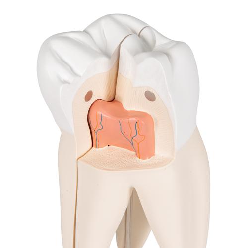 Dente molare superiore a tre radici, in 3 parti, 1017580 [D10/5], Modelli Dentali