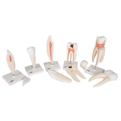 치아 모형, 5가지 타입 Human Tooth Models Set "Classic Series", 5 Models, 1017588 [D10], 치아 모형